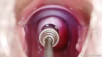 Blonde Beauty Undergoes Vaginal And Rectal Examination In A Hospital Setting